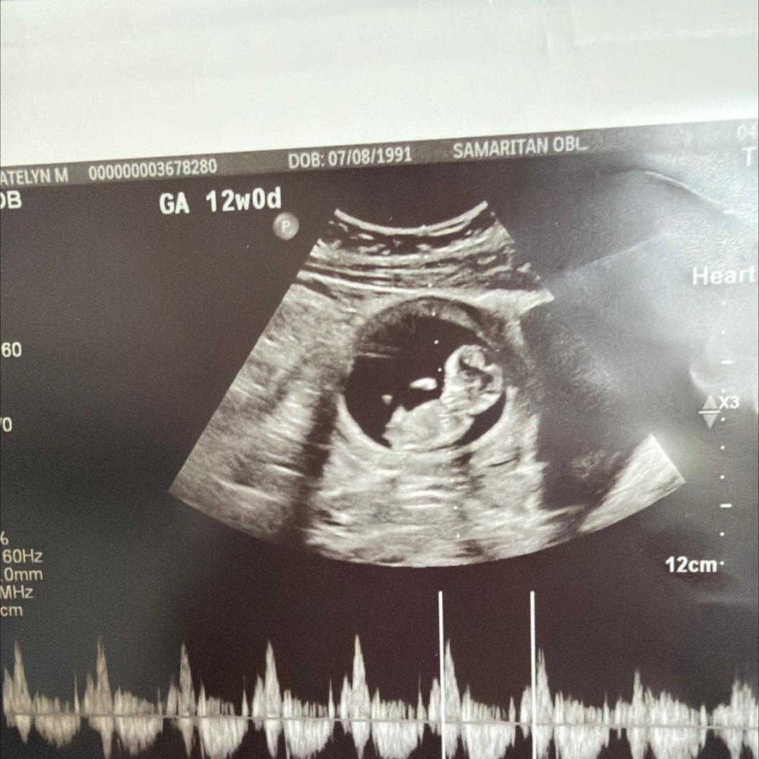 Photo shared by Katelyn for their Babylist baby registry.