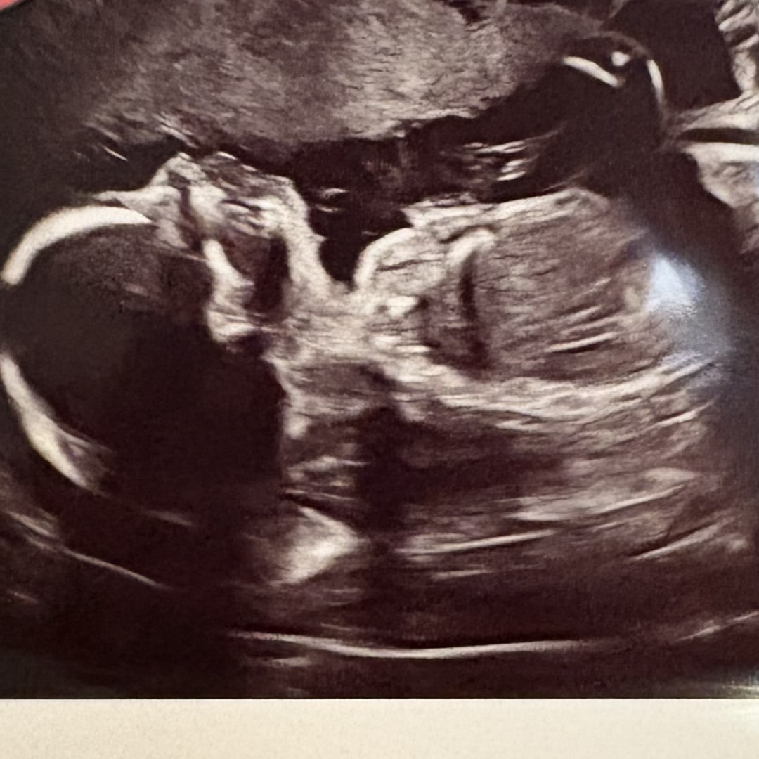 Photo shared by Elise for their Babylist baby registry.