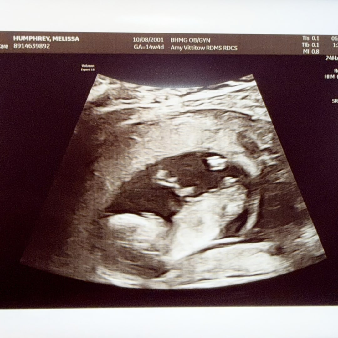 Photo shared by Melissa for their Babylist baby registry.