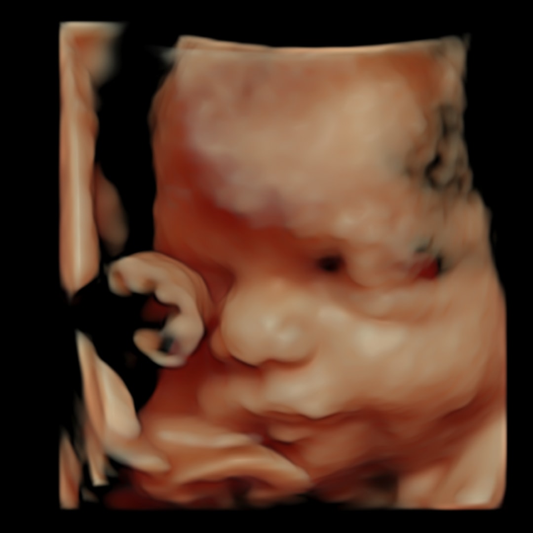 Photo shared by Tesia for their Babylist baby registry.