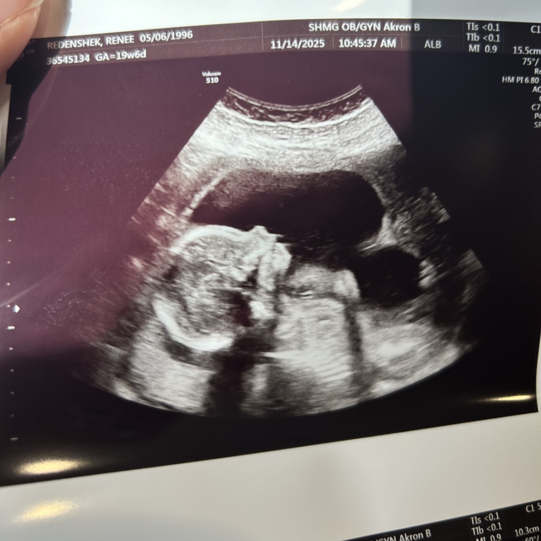 Photo shared by Renee for their Babylist baby registry.