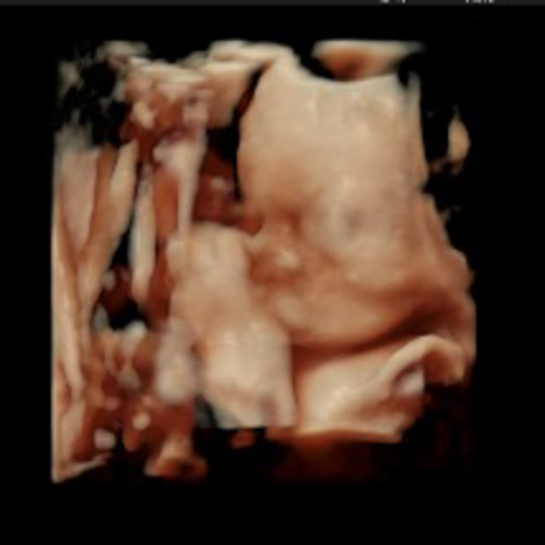 Photo shared by Jenny for their Babylist baby registry.