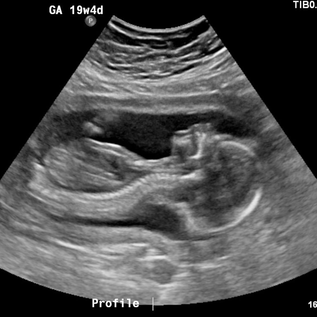 Photo shared by Bridget for their Babylist baby registry.