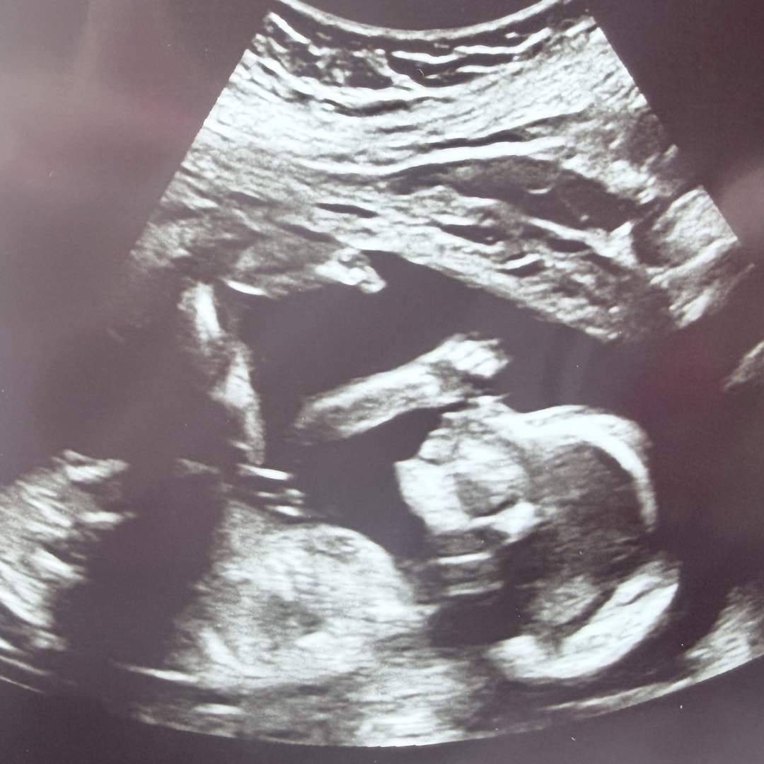 Photo shared by Kayla for their Babylist baby registry.