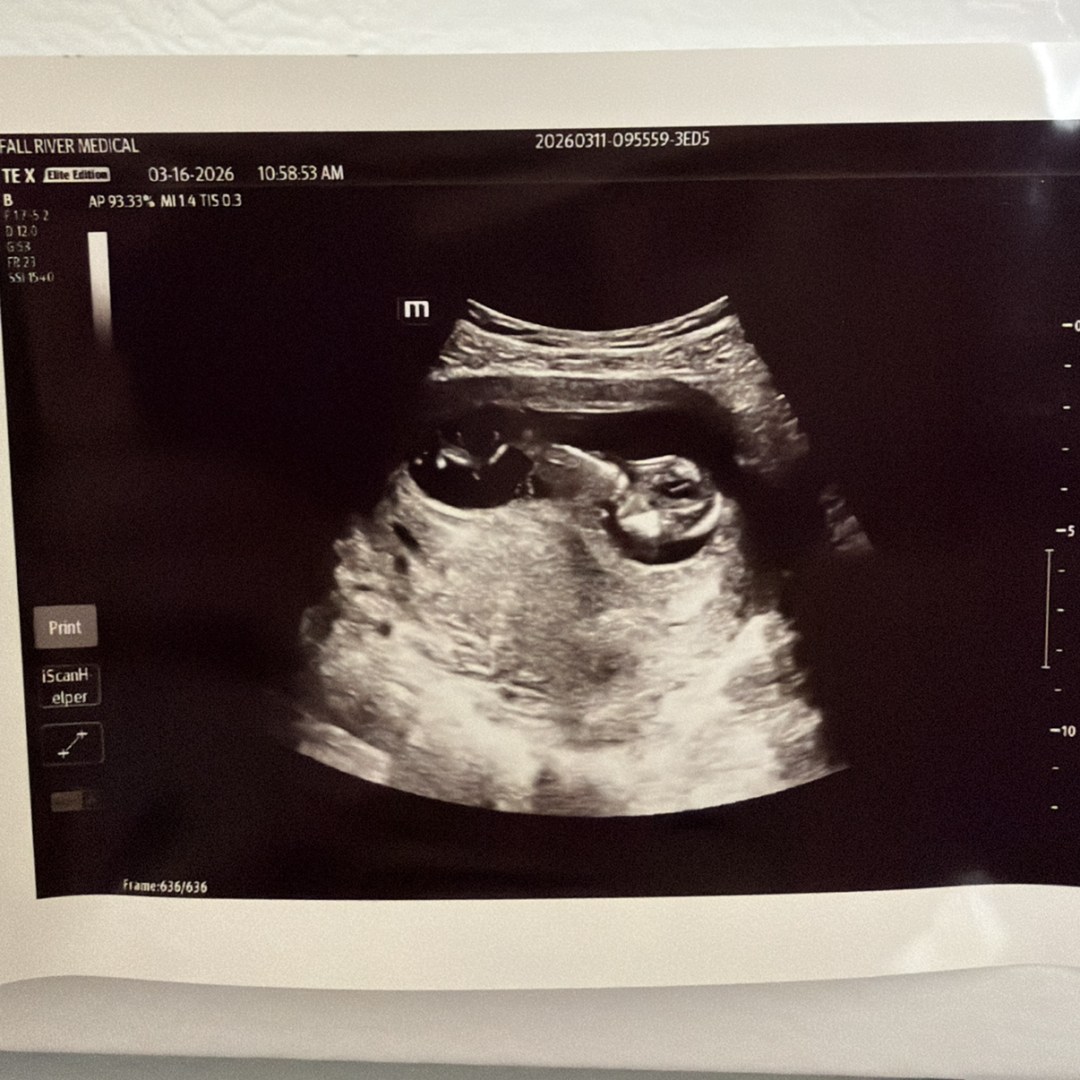 Photo shared by Rachel for their Babylist baby registry.