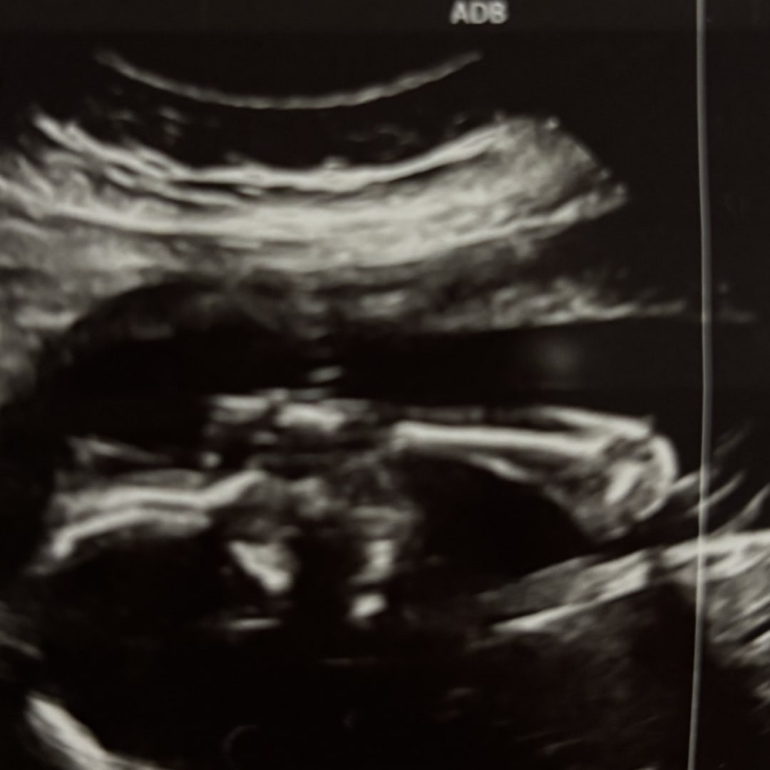 Photo shared by Fabiola for their Babylist baby registry.