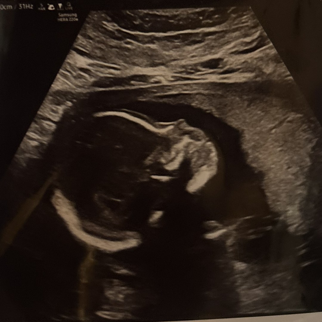 Photo shared by Sydney for their Babylist baby registry.