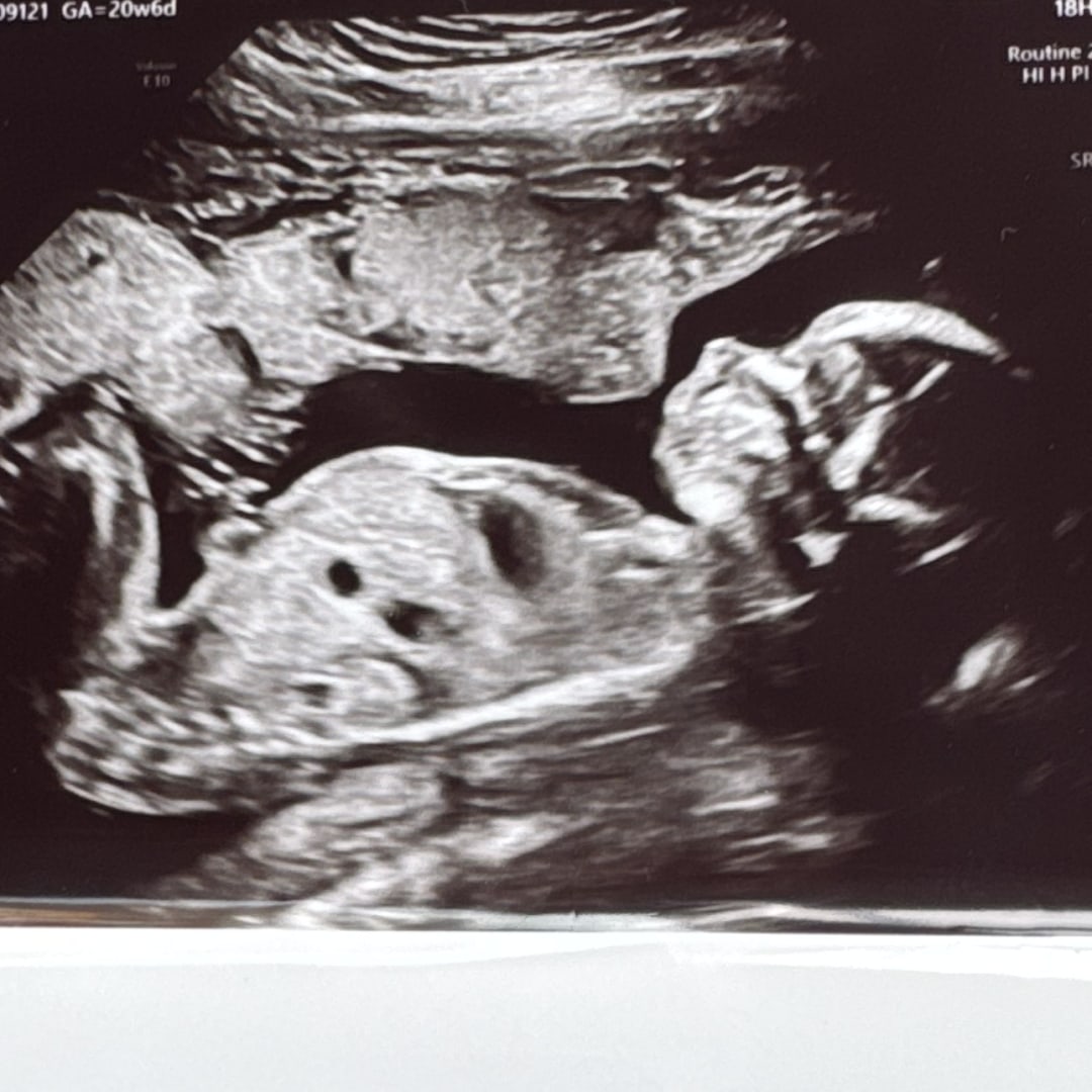 Photo shared by Sabrina for their Babylist baby registry.