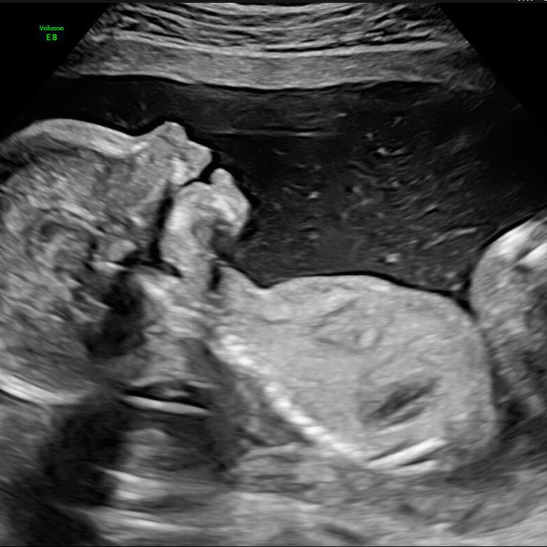 Photo shared by Sairah for their Babylist baby registry.