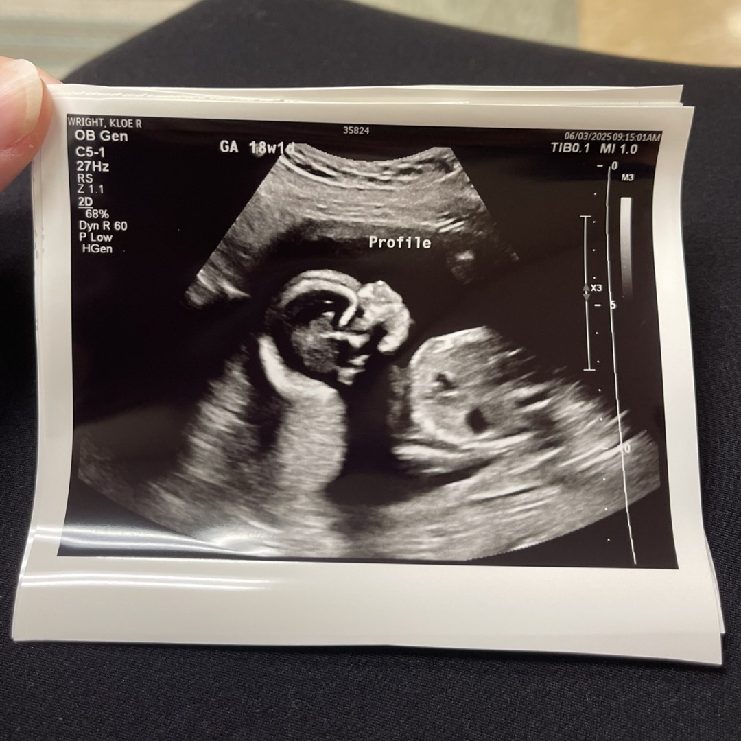 Photo shared by Kloe for their Babylist baby registry.