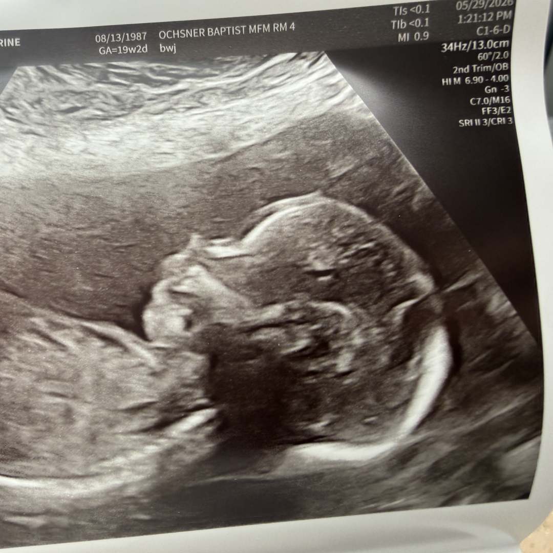 Photo shared by Catherine for their Babylist baby registry.