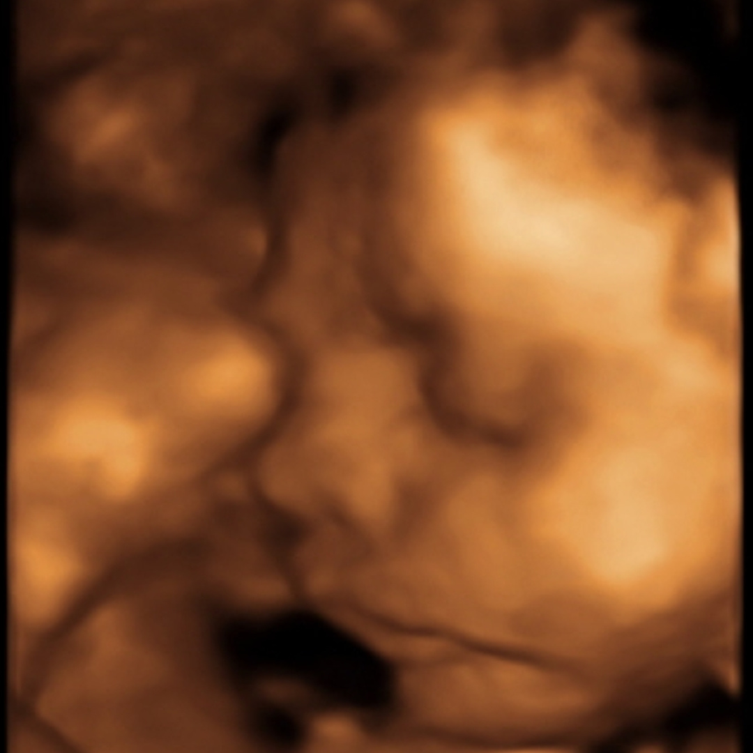 Photo shared by Nicole for their Babylist baby registry.