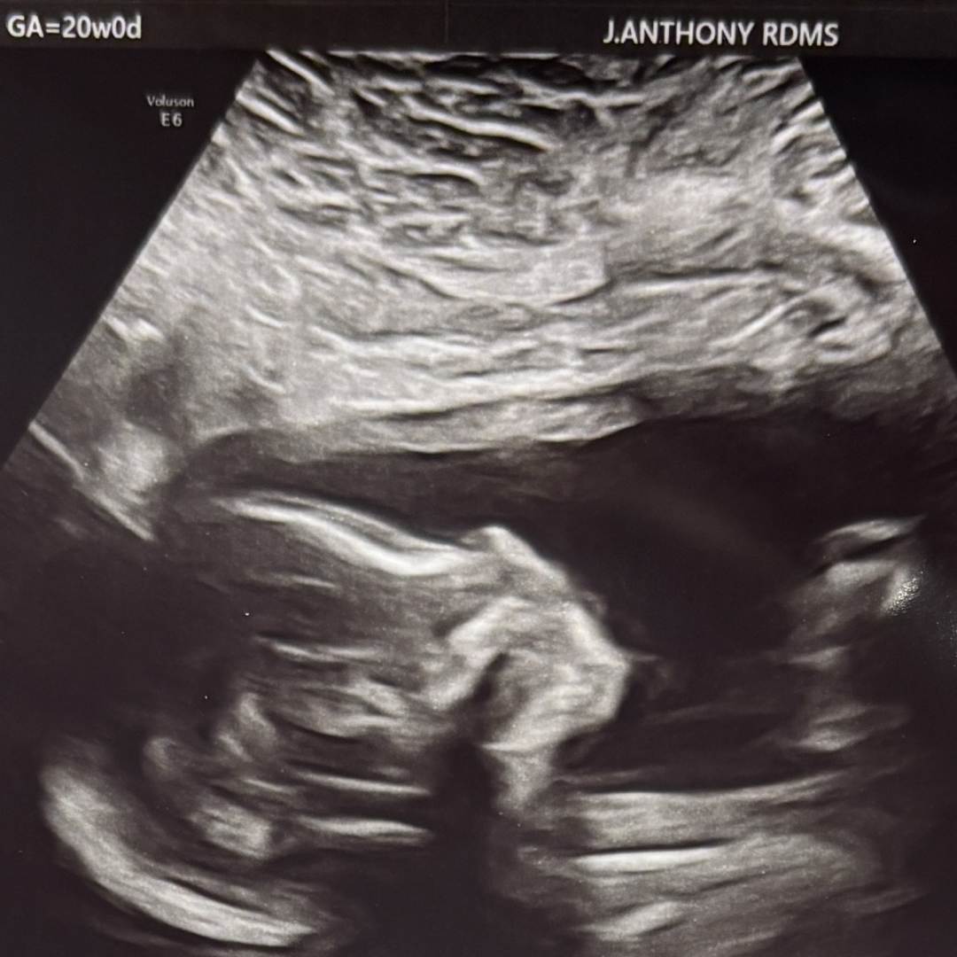 Photo shared by Amanda for their Babylist baby registry.