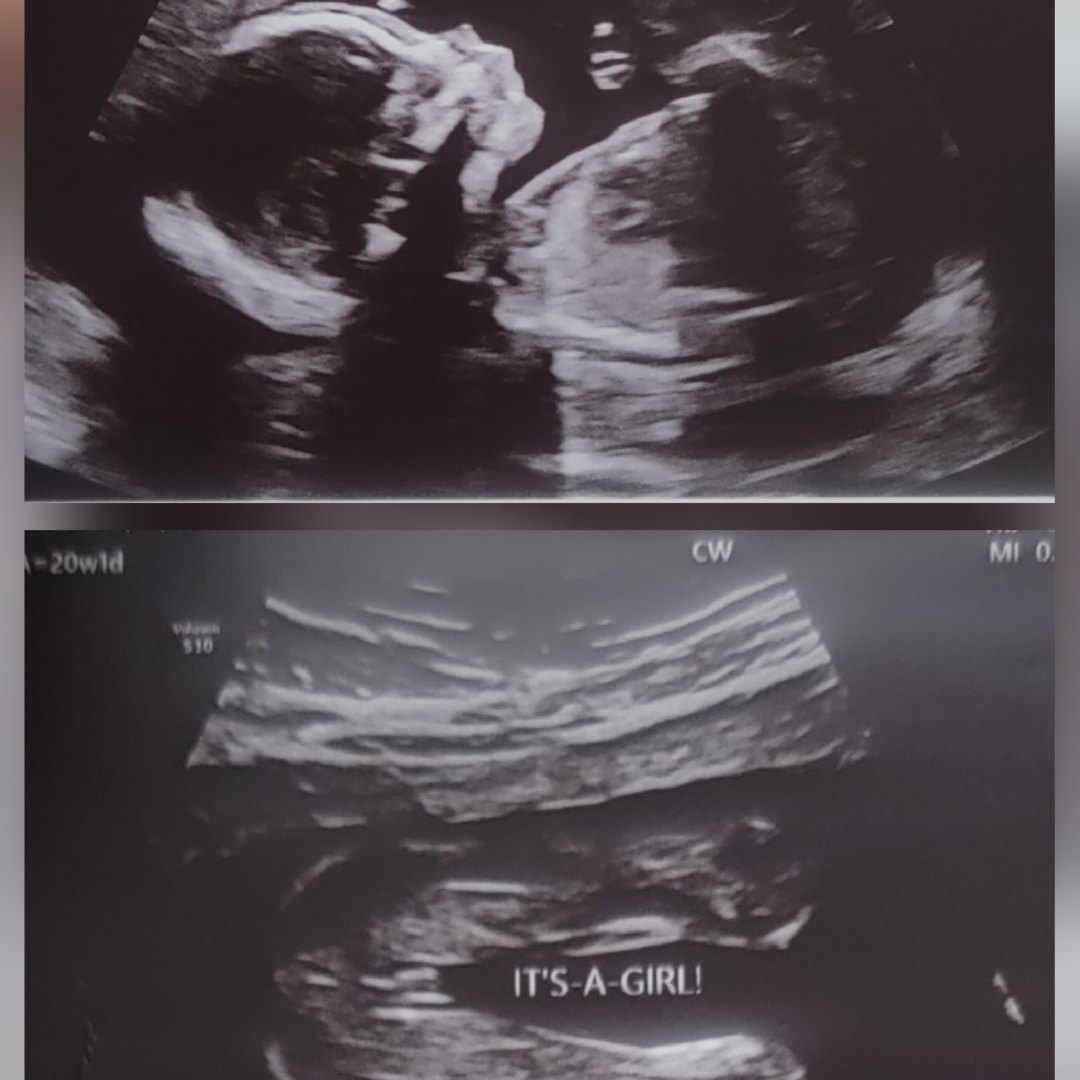 Photo shared by Lindsay for their Babylist baby registry.