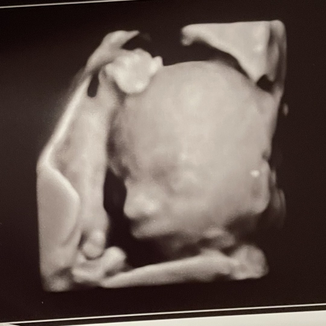 Photo shared by Hanna for their Babylist baby registry.