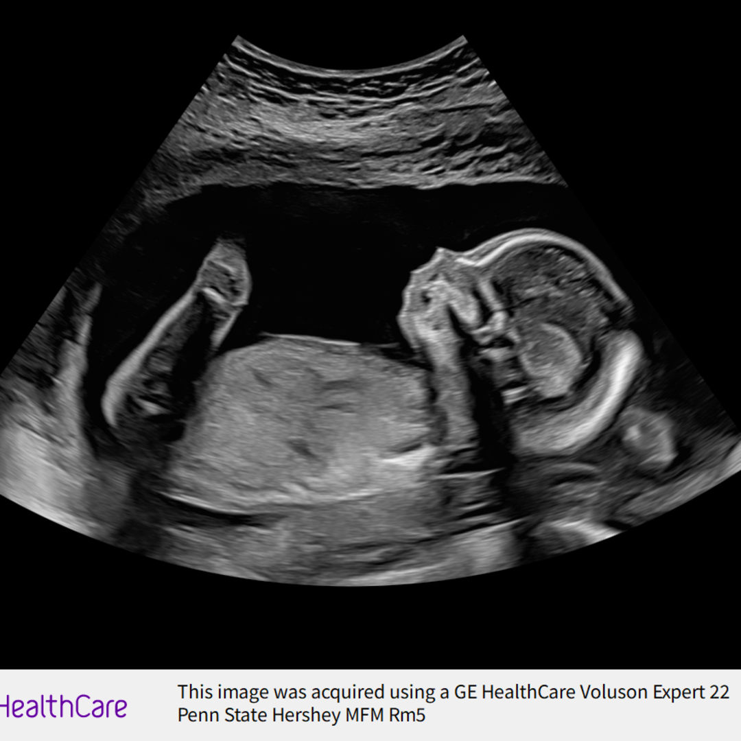 Photo shared by Emily for their Babylist baby registry.