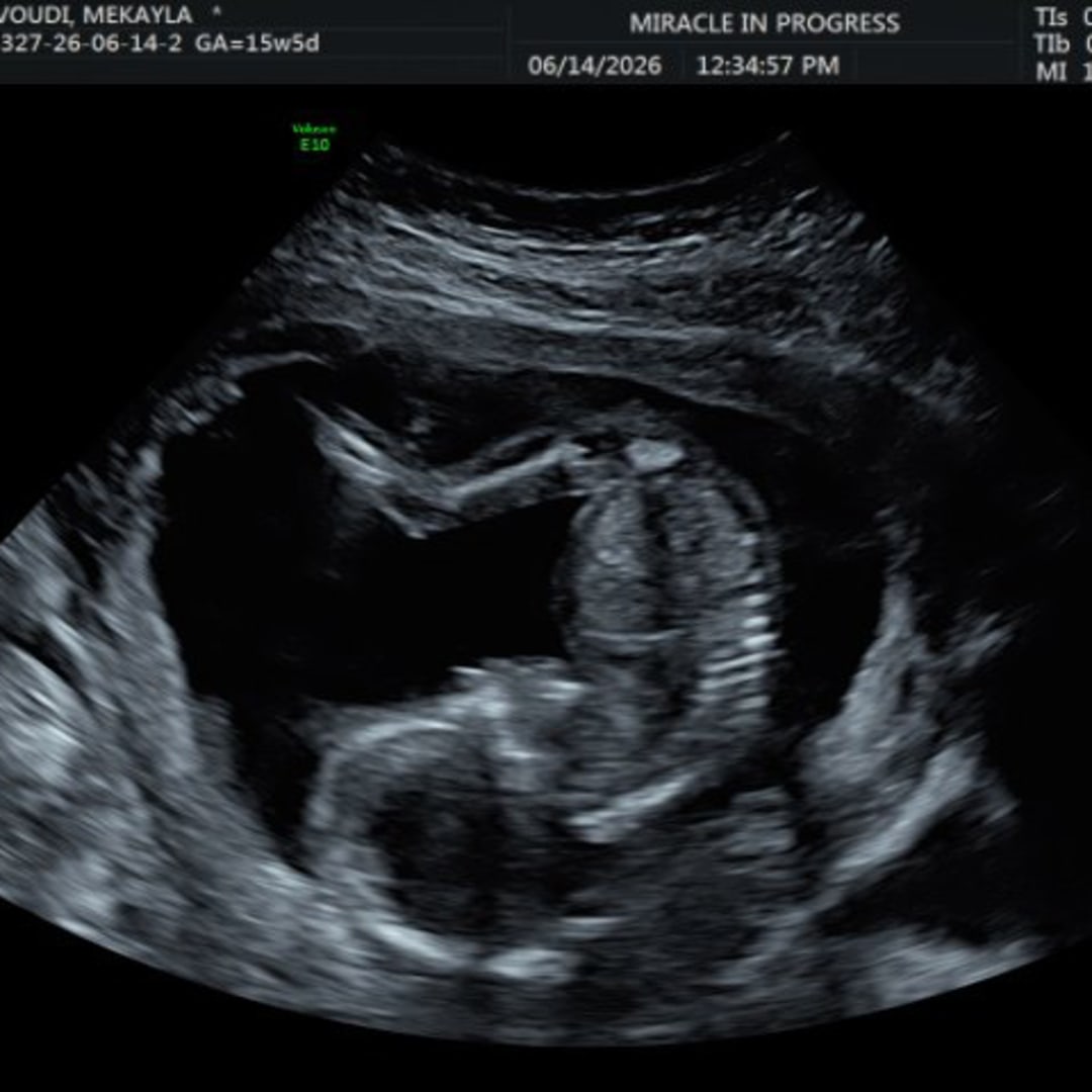 Photo shared by Mekayla for their Babylist baby registry.