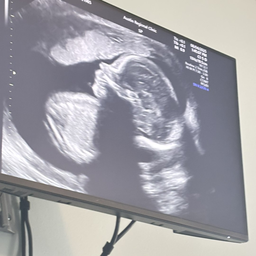 Photo shared by Nayeli for their Babylist baby registry.