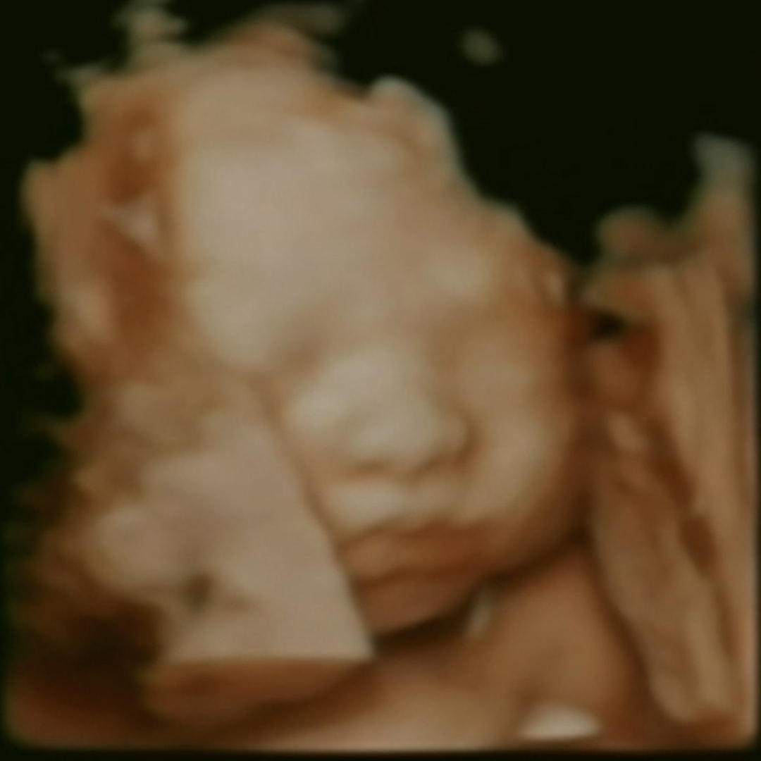 Photo shared by Abigail for their Babylist baby registry.