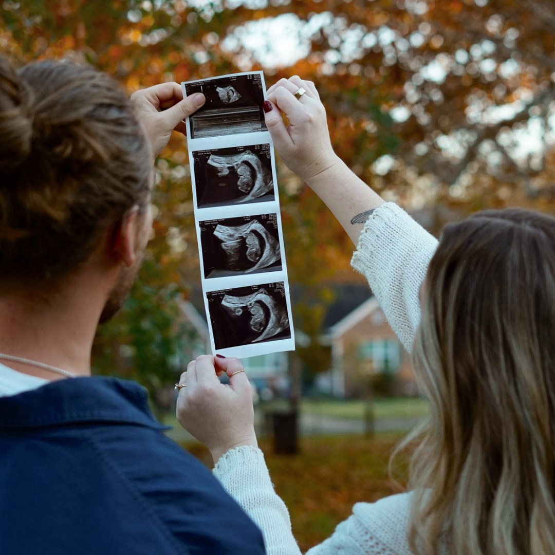 Photo shared by Abby for their Babylist baby registry.