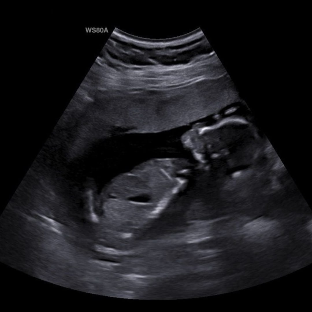 Photo shared by Eliot for their Babylist baby registry.