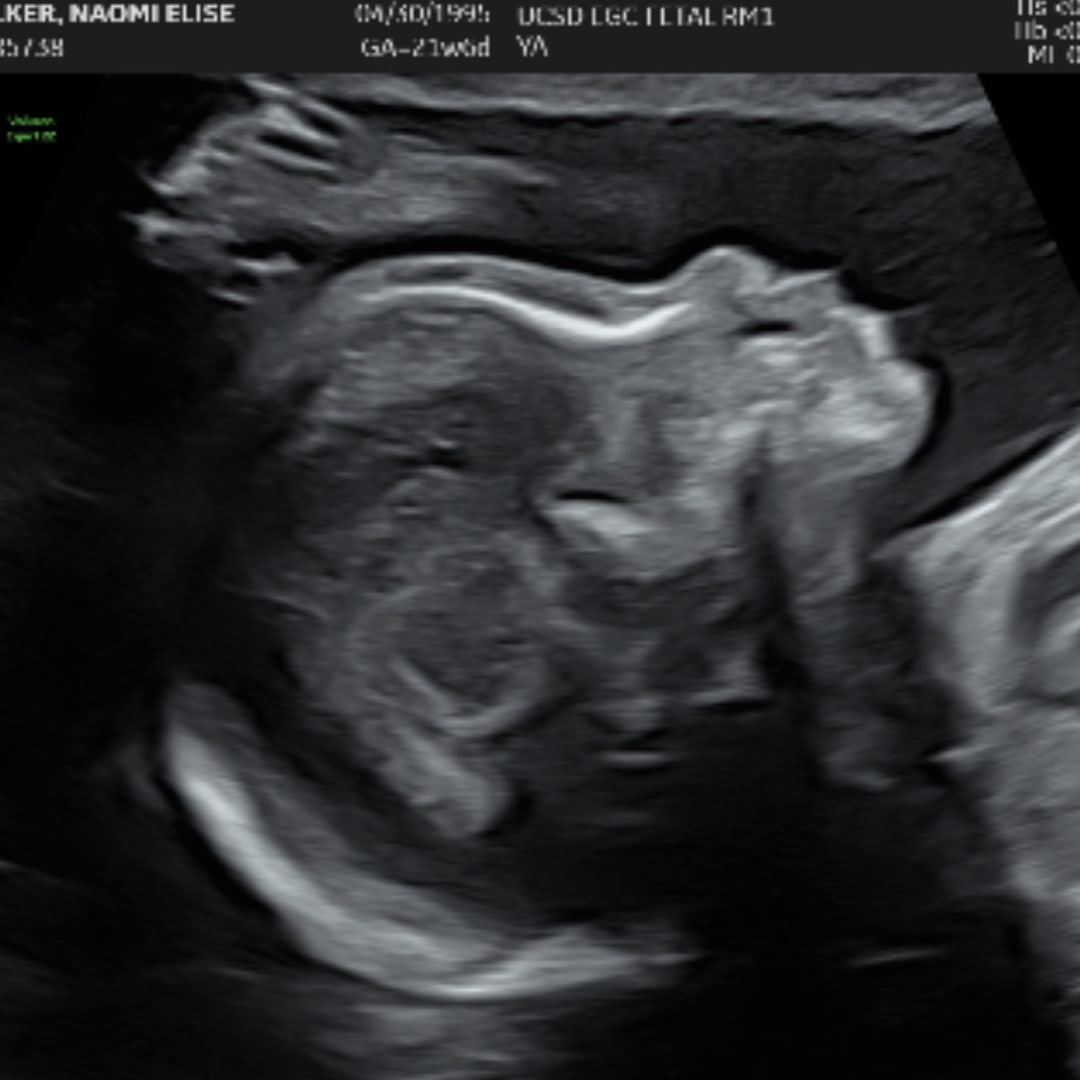 Photo shared by Naomi for their Babylist baby registry.