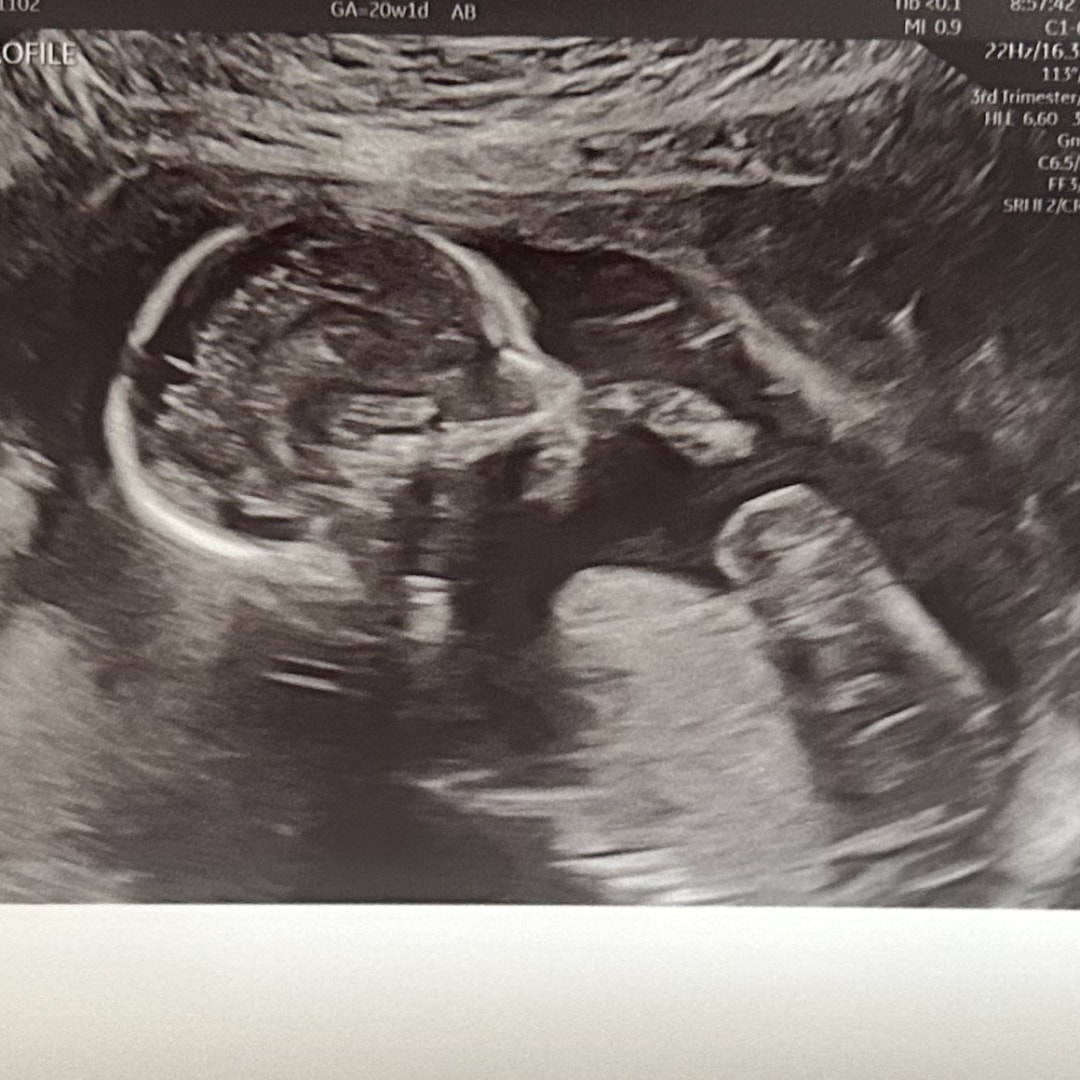 Photo shared by Hannah for their Babylist baby registry.