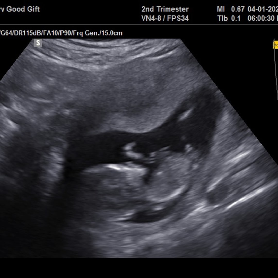 Photo shared by Hannah for their Babylist baby registry.