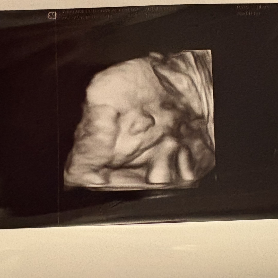 Photo shared by Kelly for their Babylist baby registry.