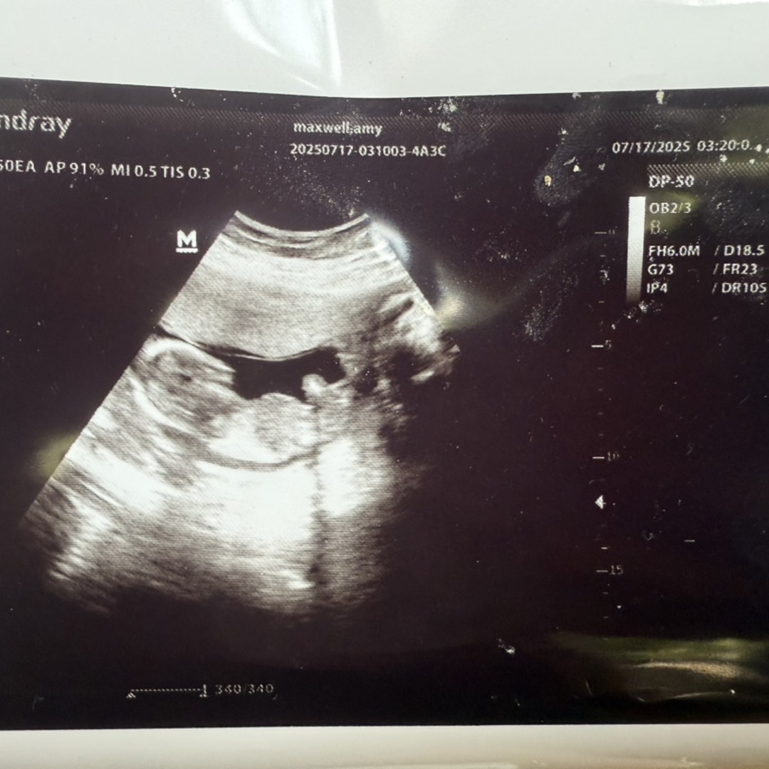 Photo shared by Amy for their Babylist baby registry.
