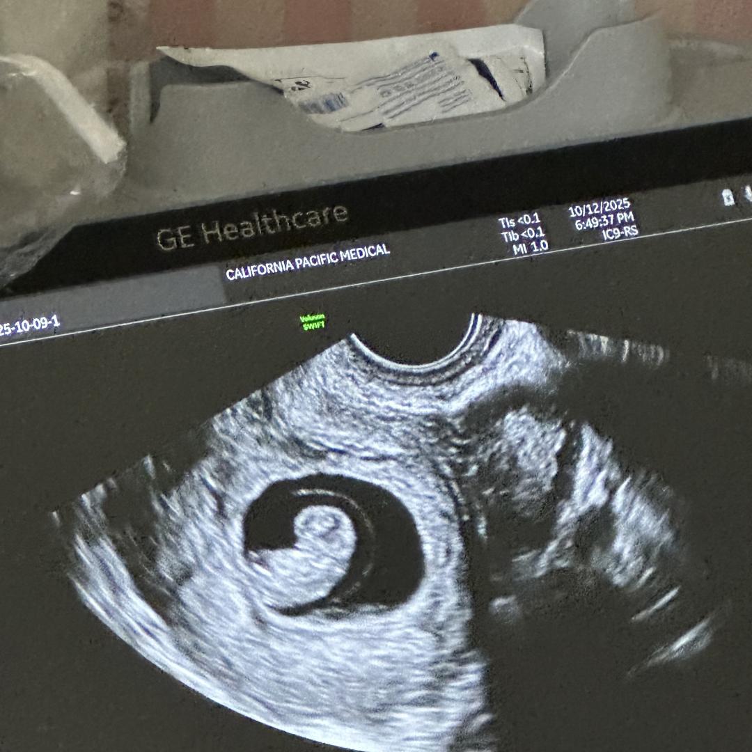 Photo shared by Reyonce for their Babylist baby registry.