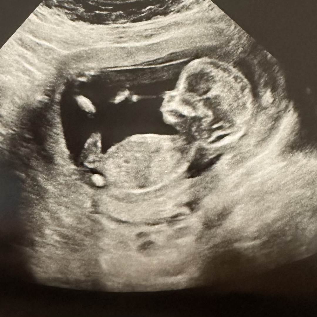 Photo shared by Laken for their Babylist baby registry.