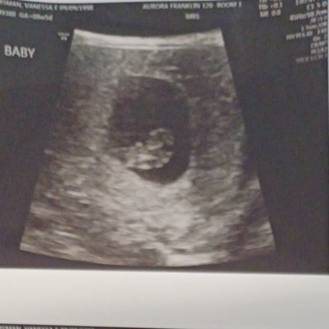 Photo shared by Vanessa for their Babylist baby registry.