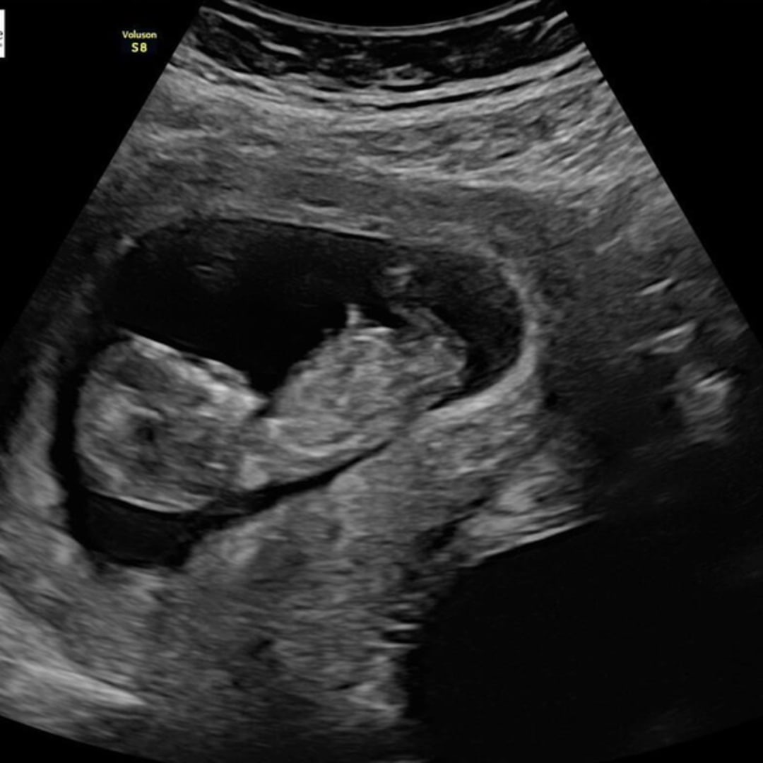 Photo shared by Savannah for their Babylist baby registry.