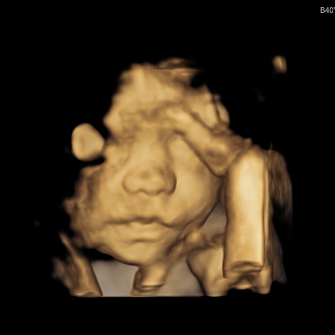 Photo shared by Kyla for their Babylist baby registry.