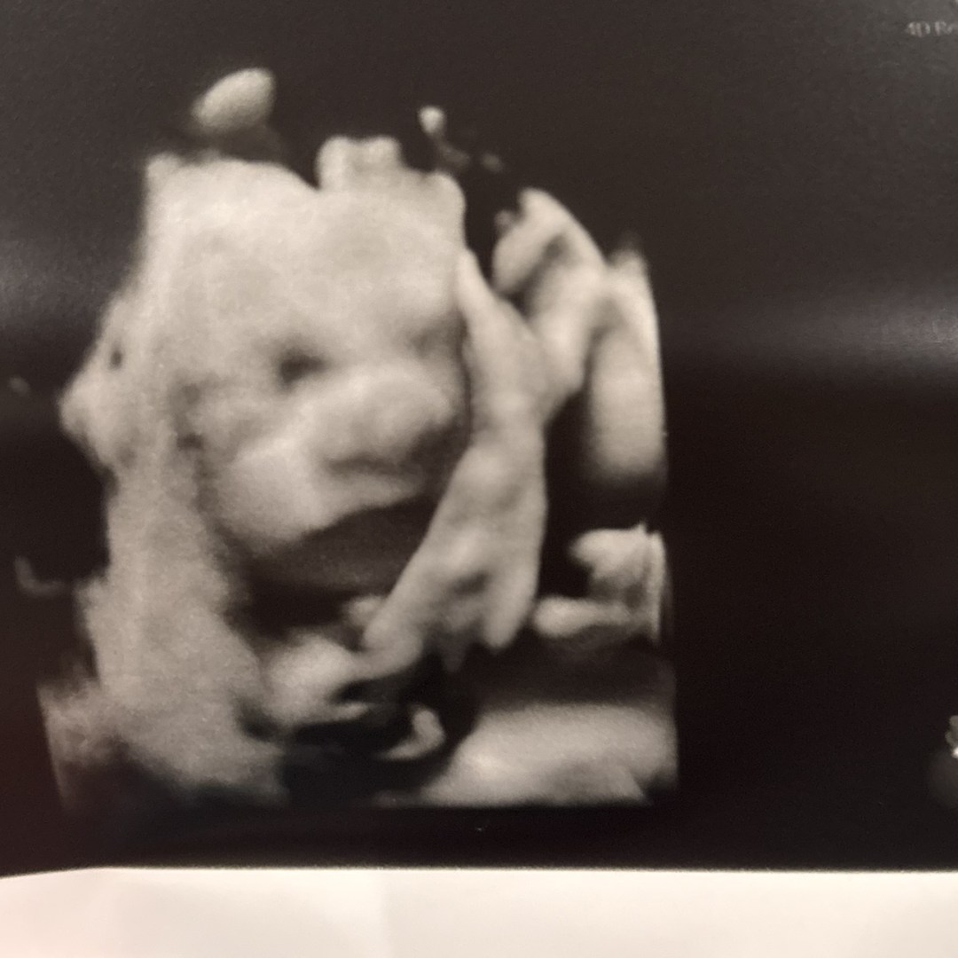 Photo shared by Olivia for their Babylist baby registry.