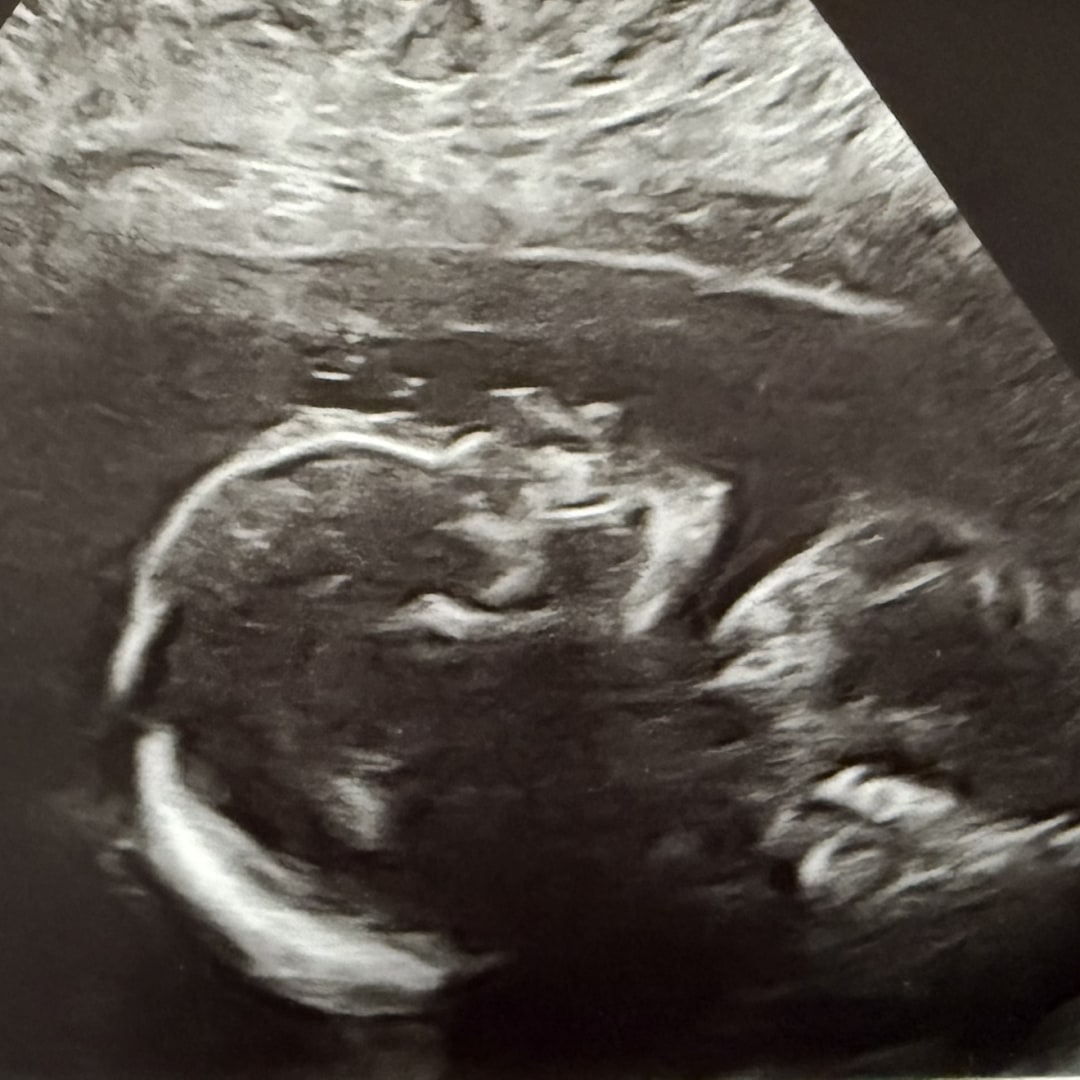 Photo shared by Victoria for their Babylist baby registry.