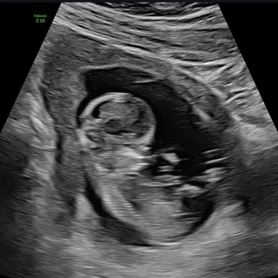Photo shared by Brianna for their Babylist baby registry.