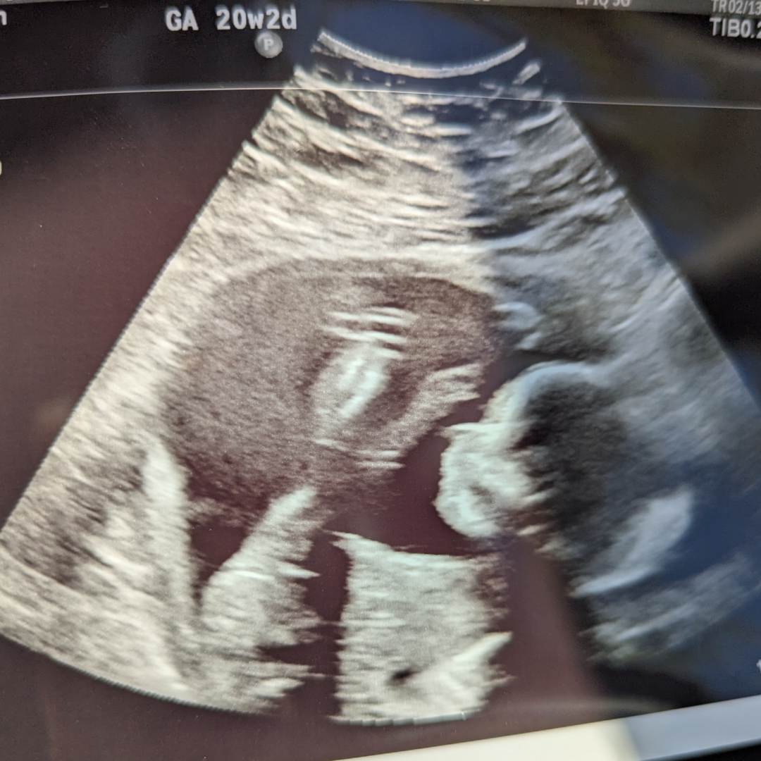 Photo shared by Sarah for their Babylist baby registry.