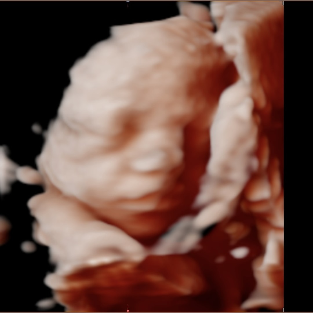 Photo shared by Morgan for their Babylist baby registry.