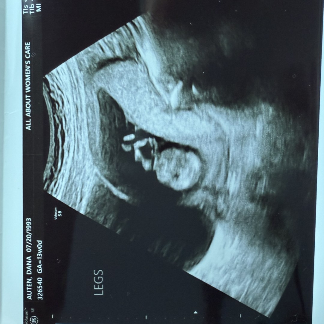 Photo shared by Dana for their Babylist baby registry.