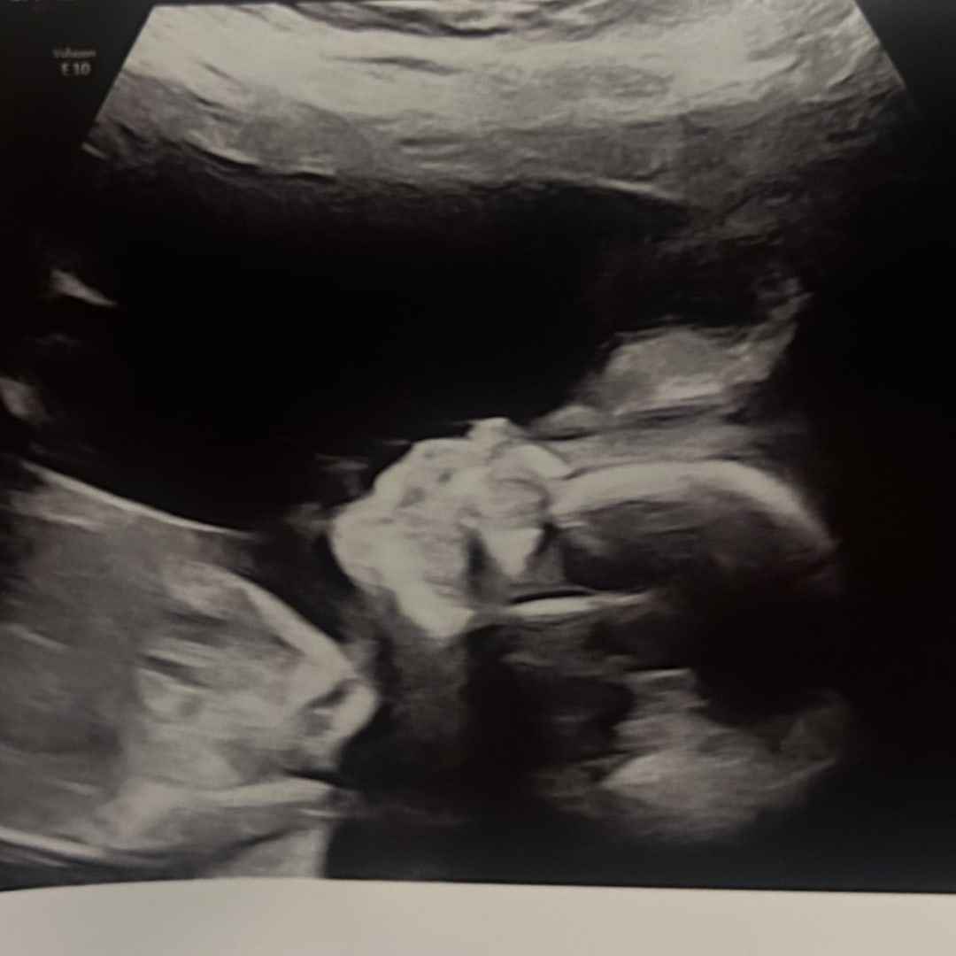 Photo shared by Jocelyn for their Babylist baby registry.