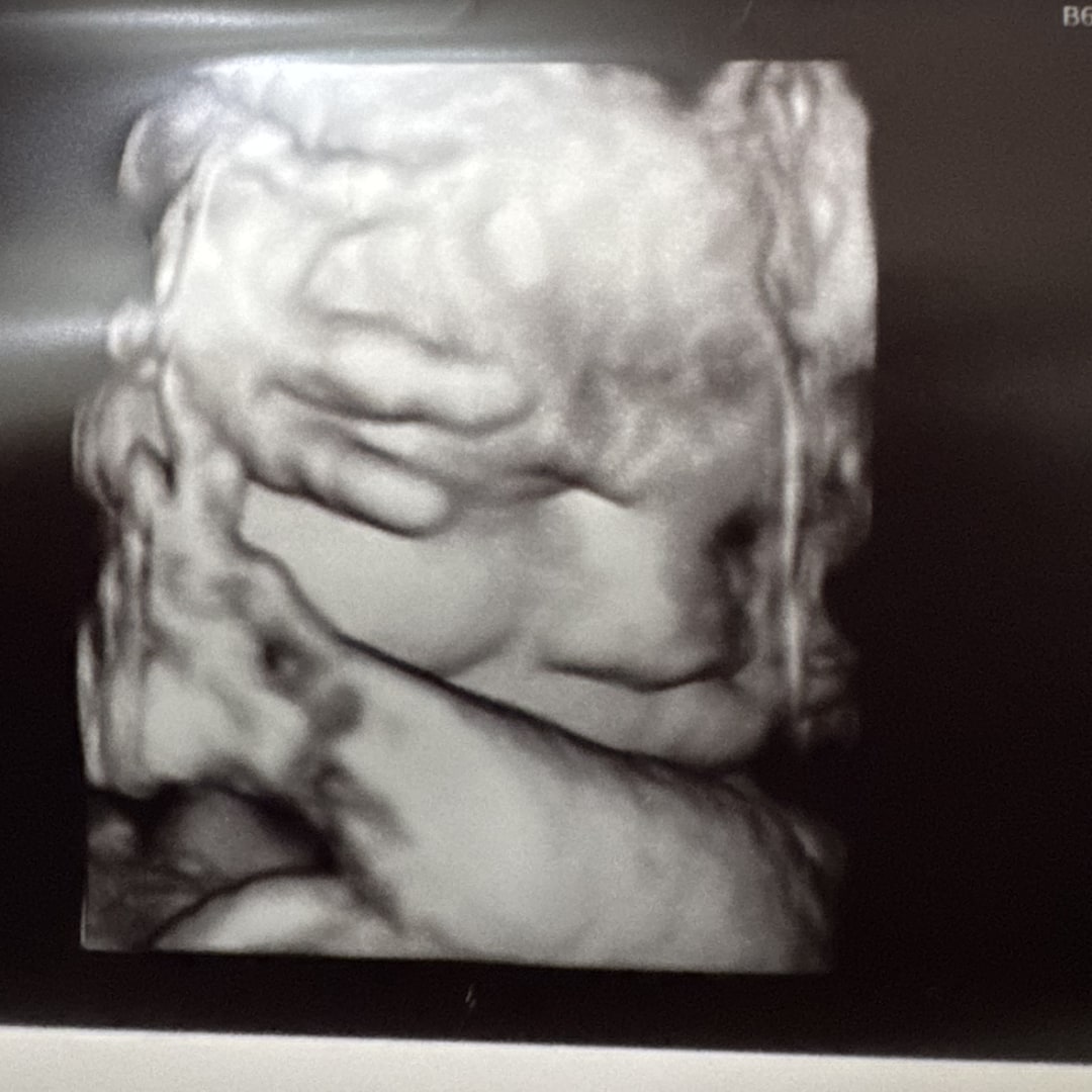 Photo shared by Samantha for their Babylist baby registry.