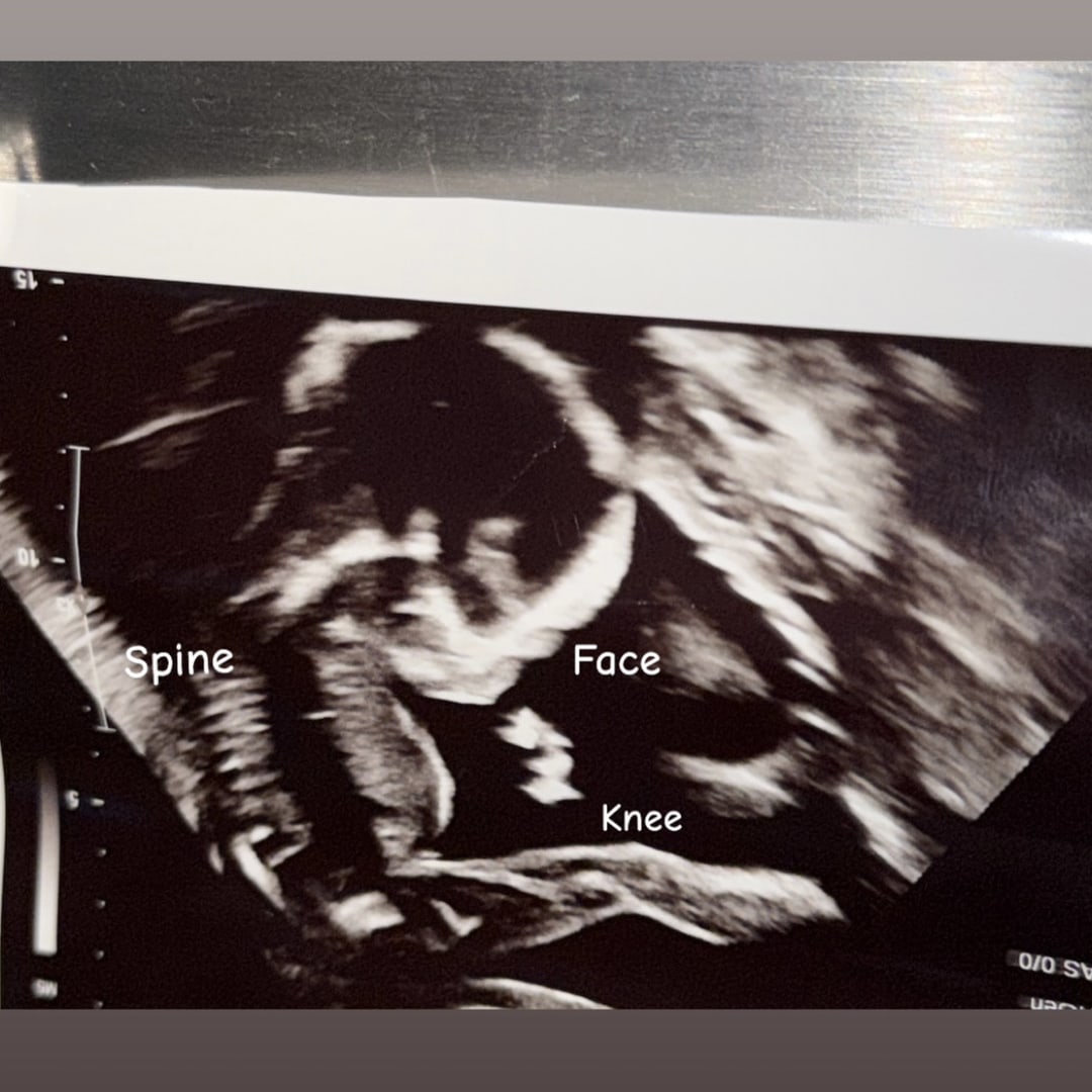 Photo shared by Brittany & Eric for their Babylist baby registry.