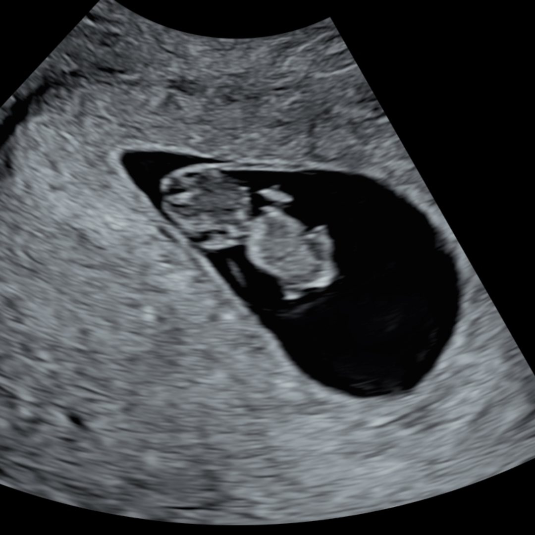 Photo shared by Lizzy for their Babylist baby registry.