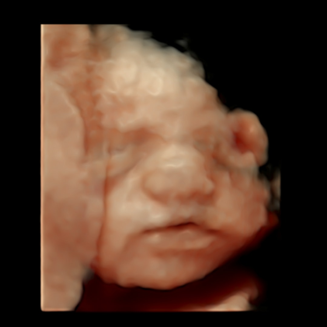 Photo shared by Alyssa for their Babylist baby registry.