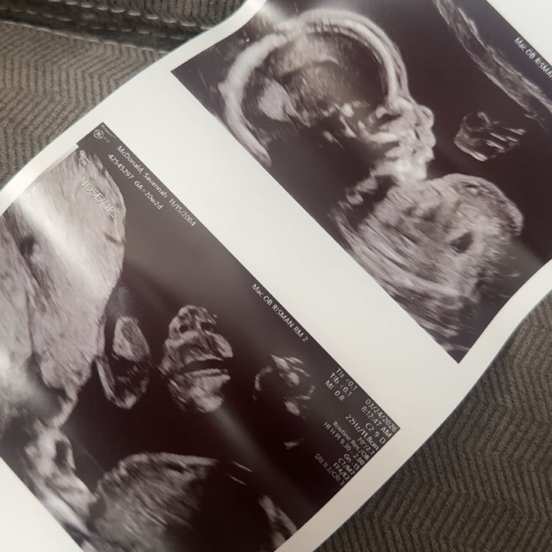 Photo shared by Savannah for their Babylist baby registry.