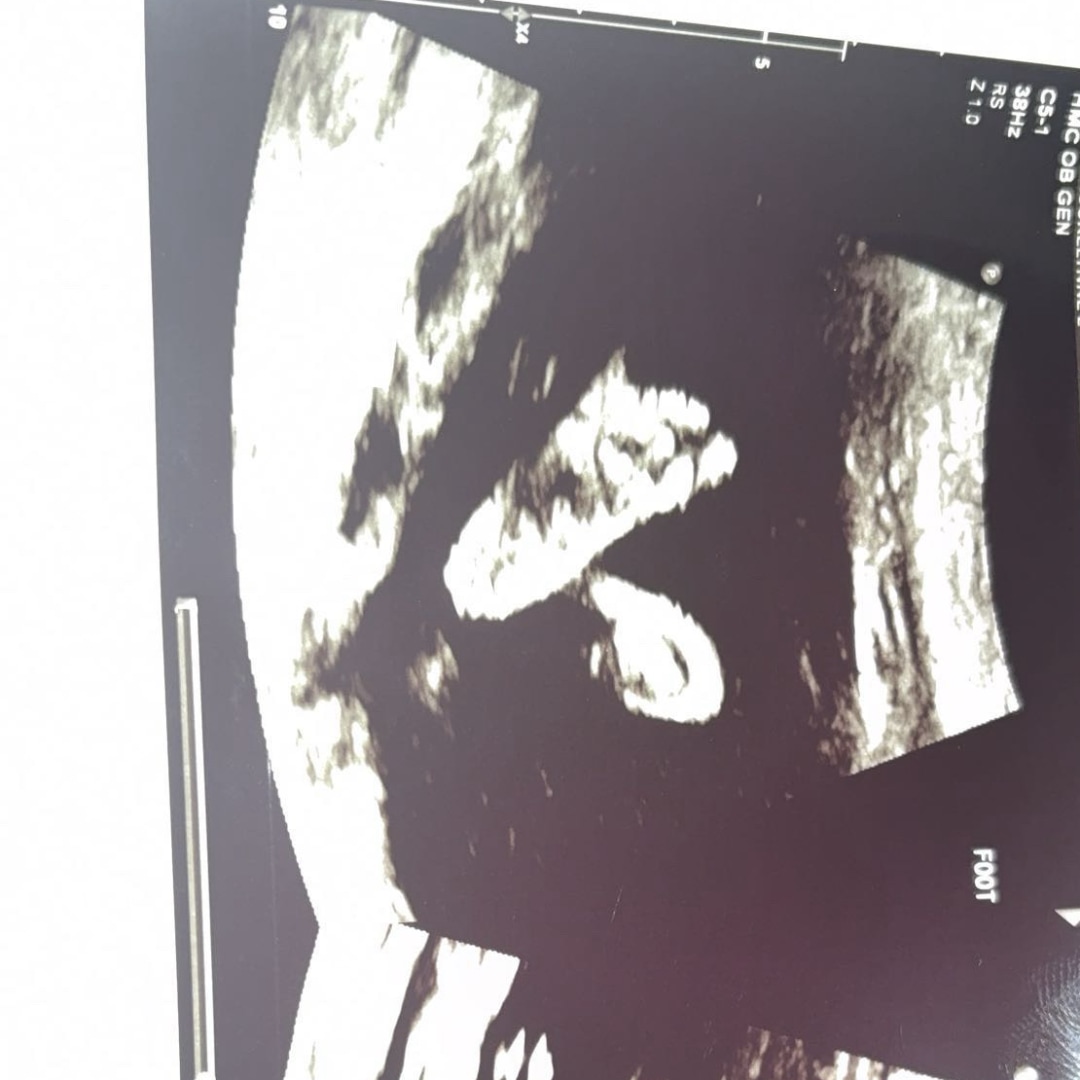 Photo shared by Brooke for their Babylist baby registry.