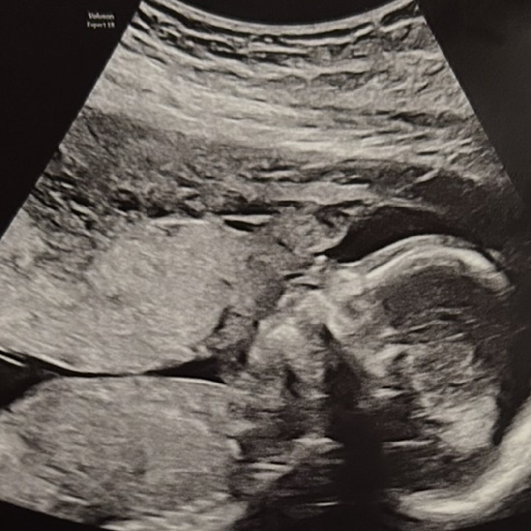 Photo shared by Promise for their Babylist baby registry.