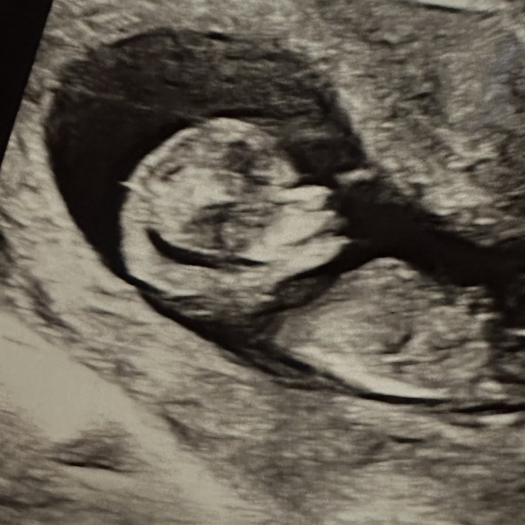 Photo shared by Beatrice for their Babylist baby registry.